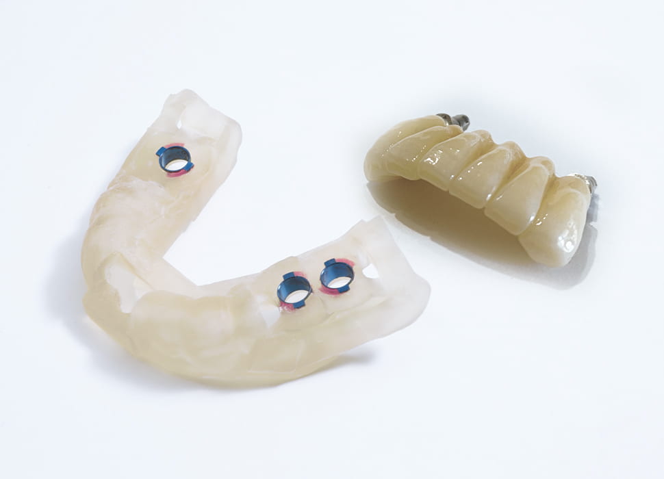 サージカルガイドの制作仮歯の準備